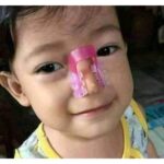 Nose shaper - Image 5