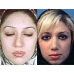 Nose shaper - Image 4